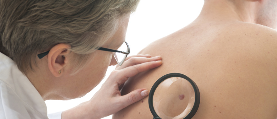 Teledermatology Program